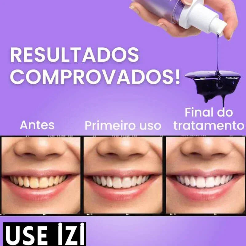 Clareador Dental iziSmile - Dentes Brancos Em Segundos [Desconto + Entrega Gratis Hoje]